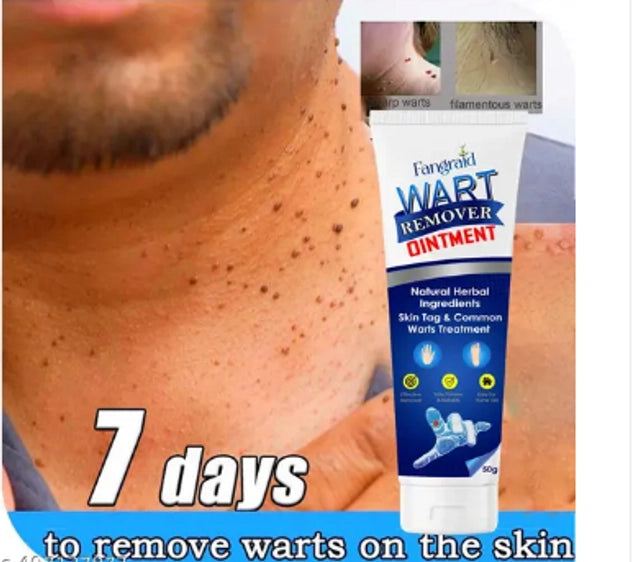 Atemporal Warts Remover Cream (100 g)